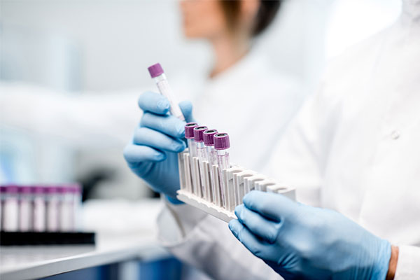 samples in a laboratory